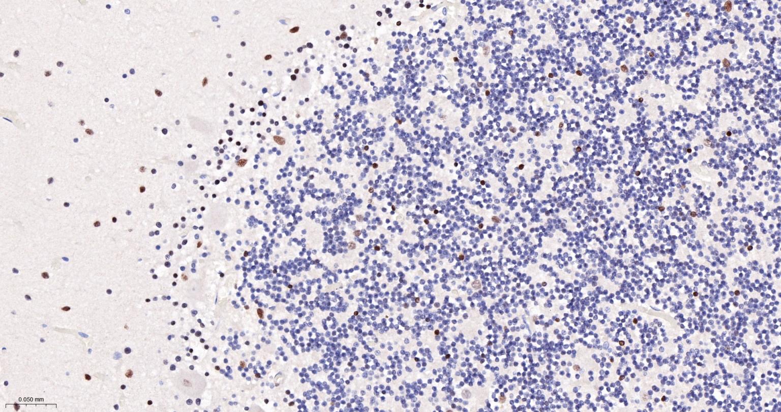 磷酸化组蛋白H2AX重组兔单抗-bsm-52163R