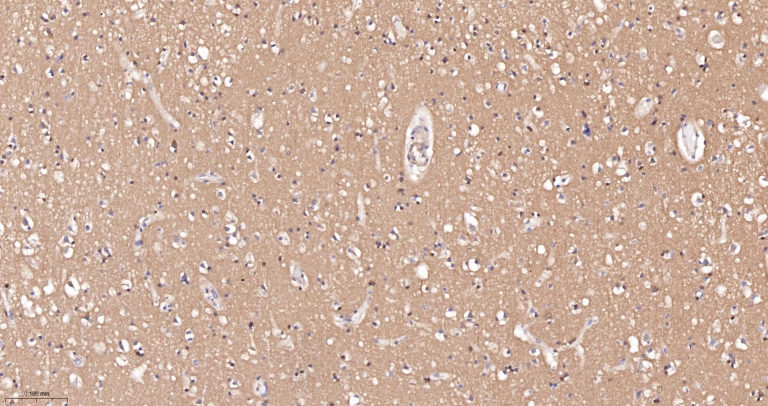 自噬效应蛋白Beclin 1重组兔单抗-bsm-61085R