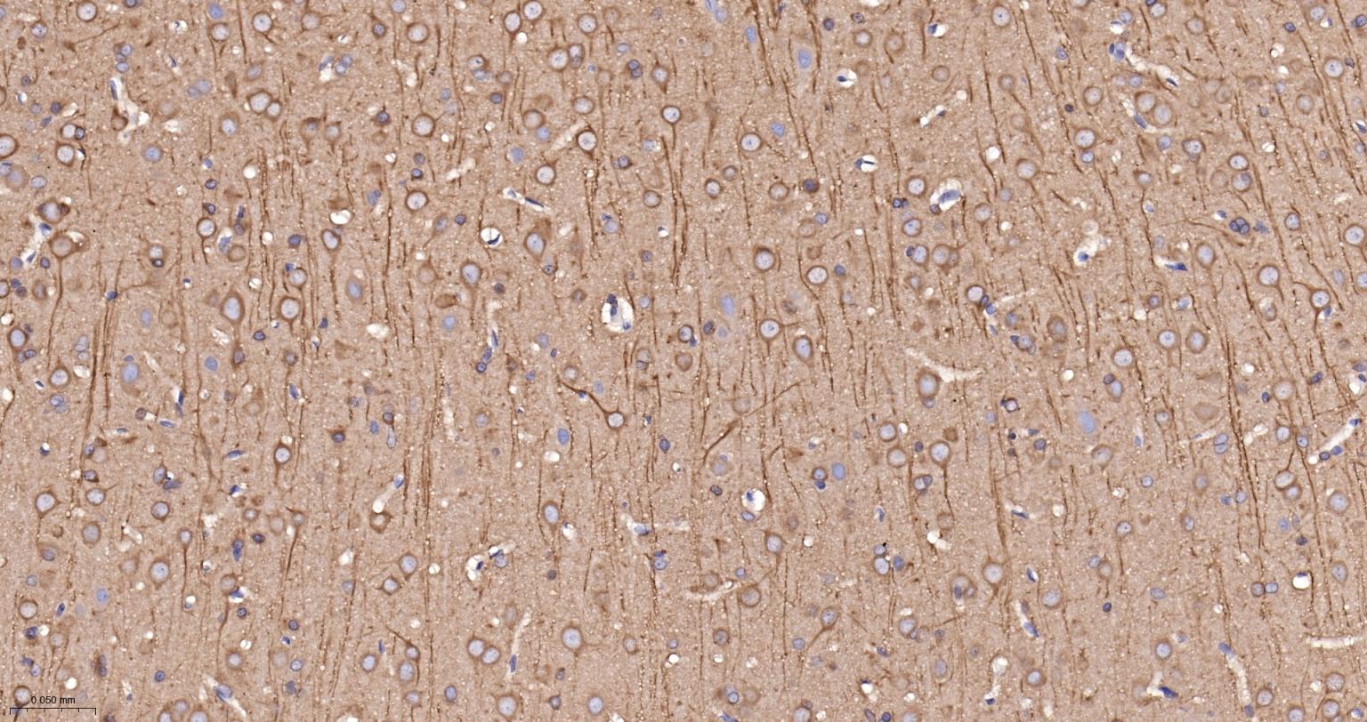 自噬效应蛋白Beclin 1重组兔单抗-bsm-61085R