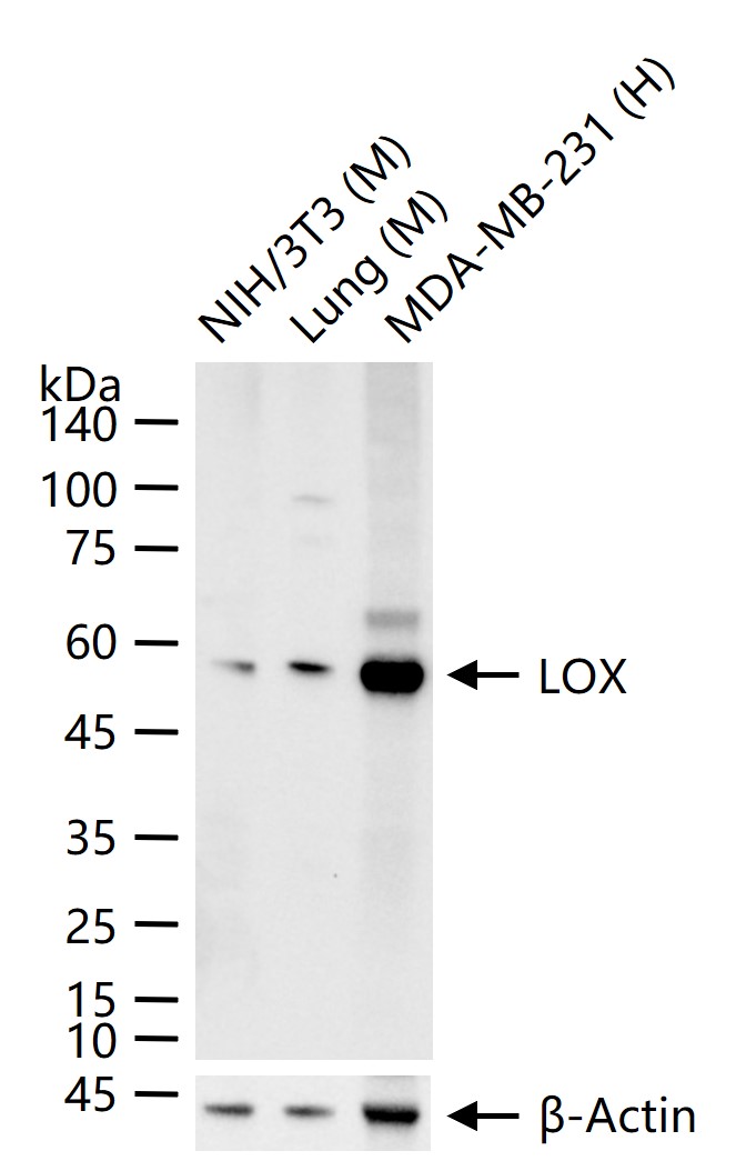 LOX Recombinant Rabbit mAb (一抗) - WB,ICC/IF | Bioss