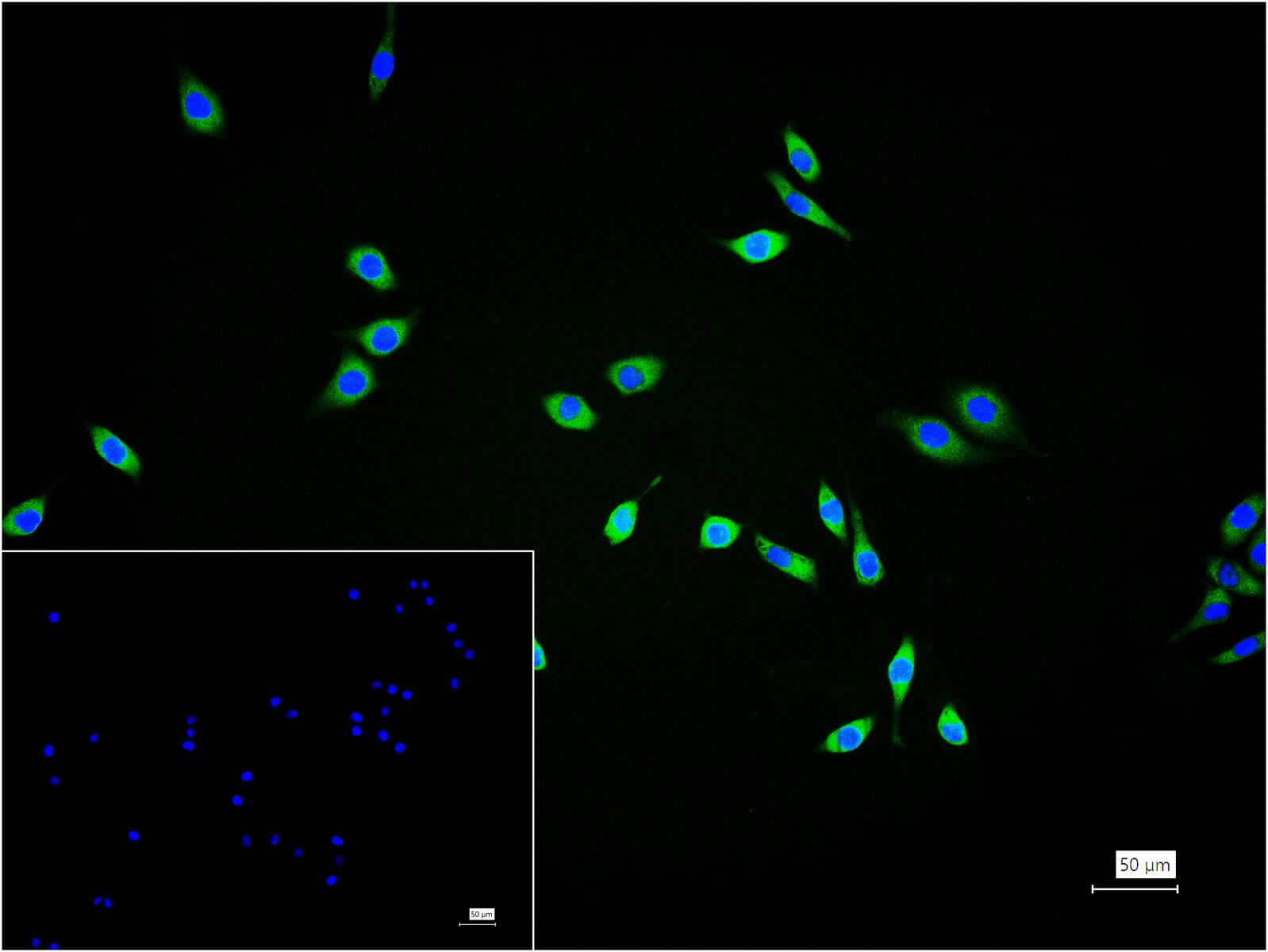 磷酸化丝裂原活化蛋白激酶激酶1重组兔单抗-bsm-52175R