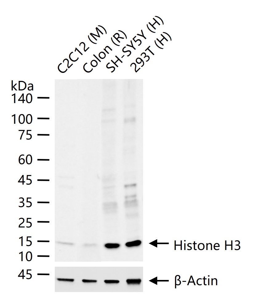 Histone H3 (NT) Recombinant Rabbit mAb (一抗) - WB,IHC-P,IHC-F,IF,ICC/IF,ChIP | Bioss