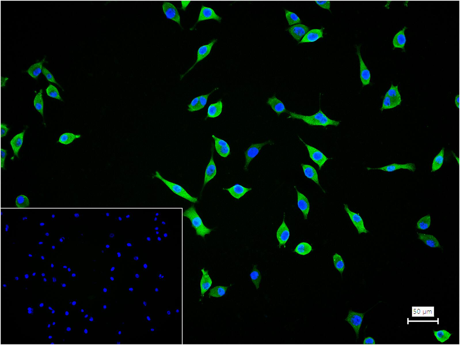半乳糖凝集素3抗体-bs-41218R