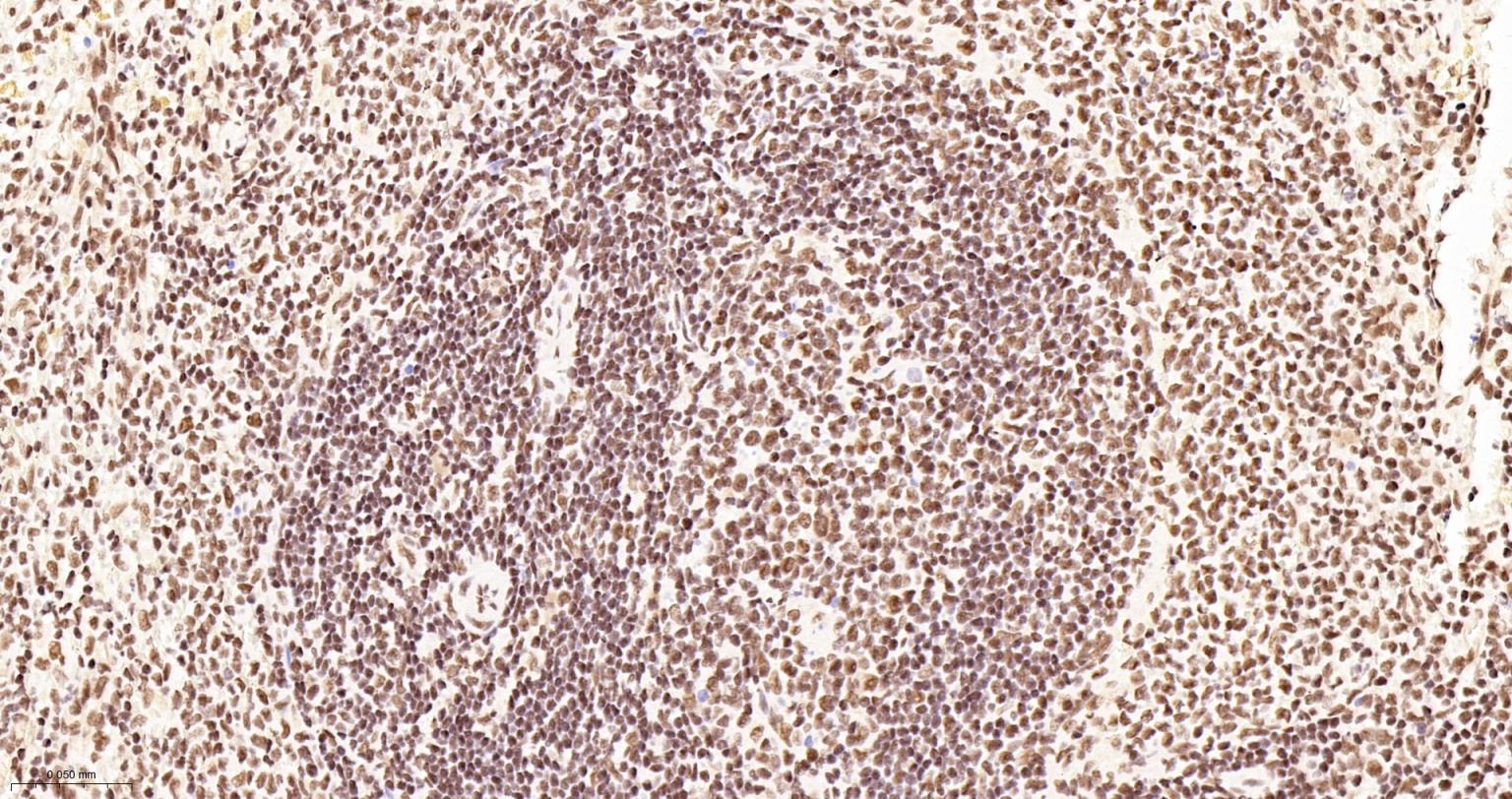 TATA结合蛋白重组兔单抗-bsm-61179R