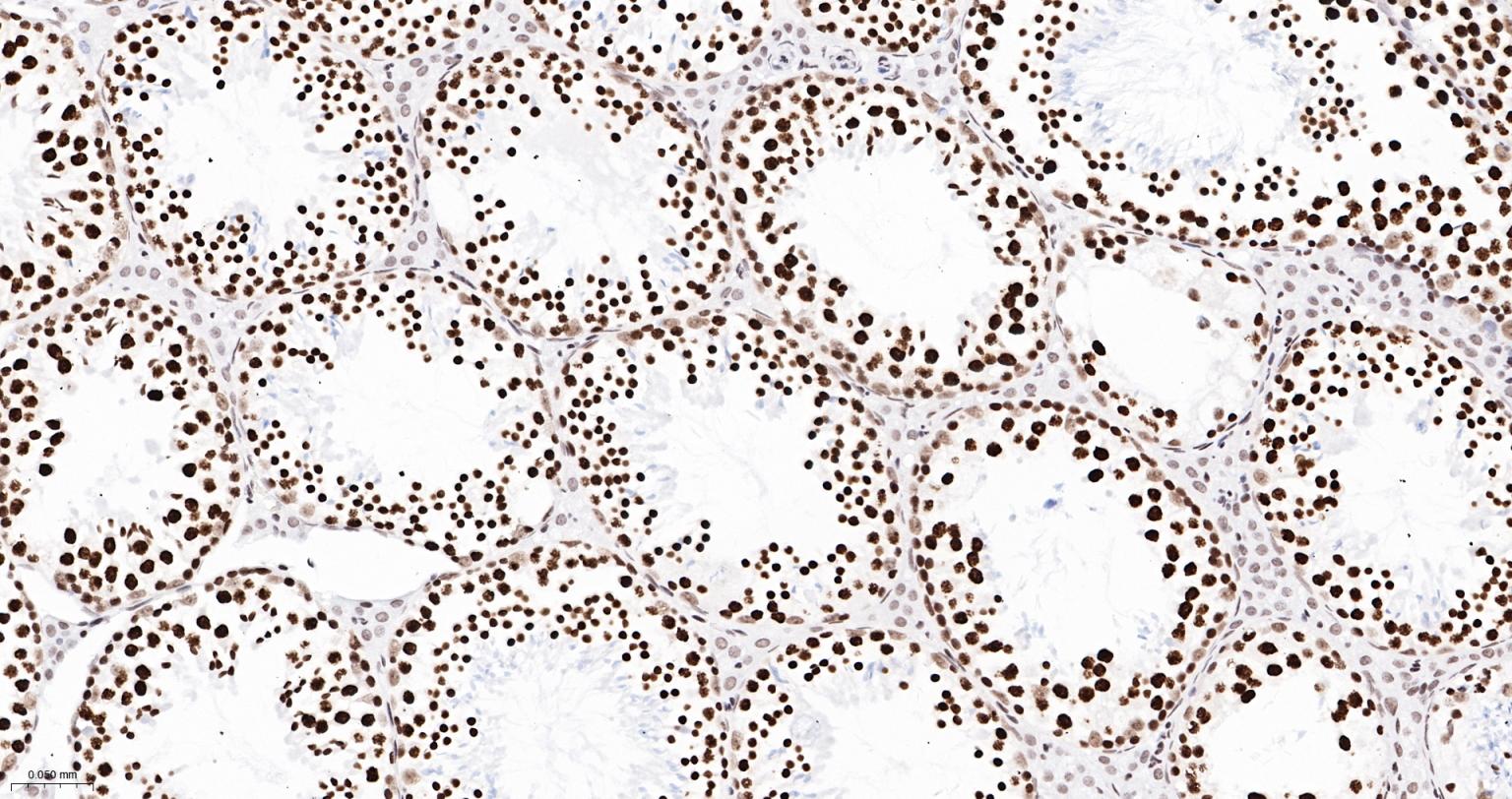 TATA结合蛋白重组兔单抗-bsm-61179R