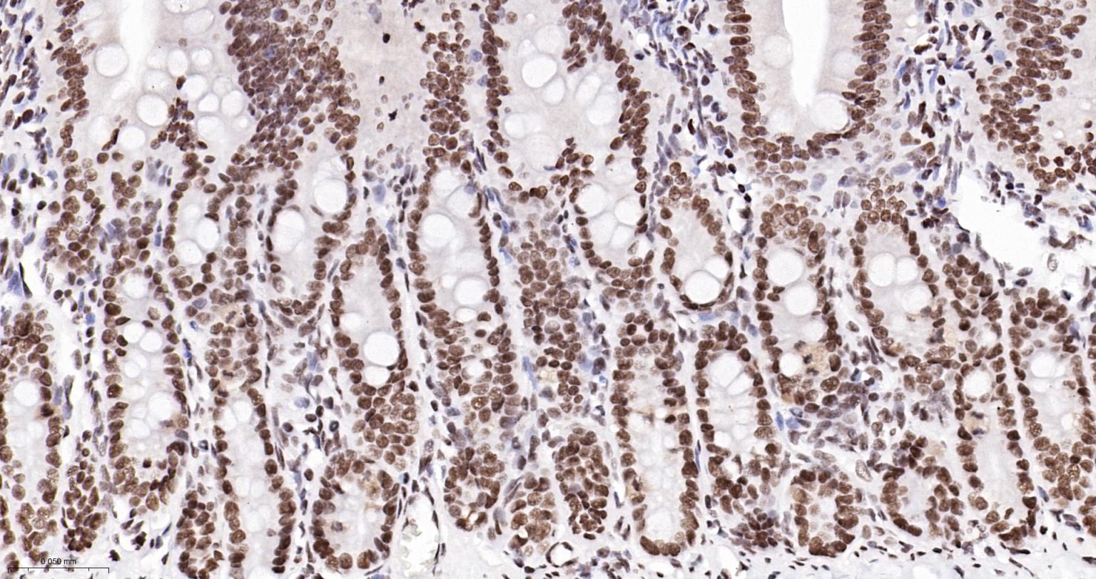 TATA结合蛋白重组兔单抗-bsm-61179R