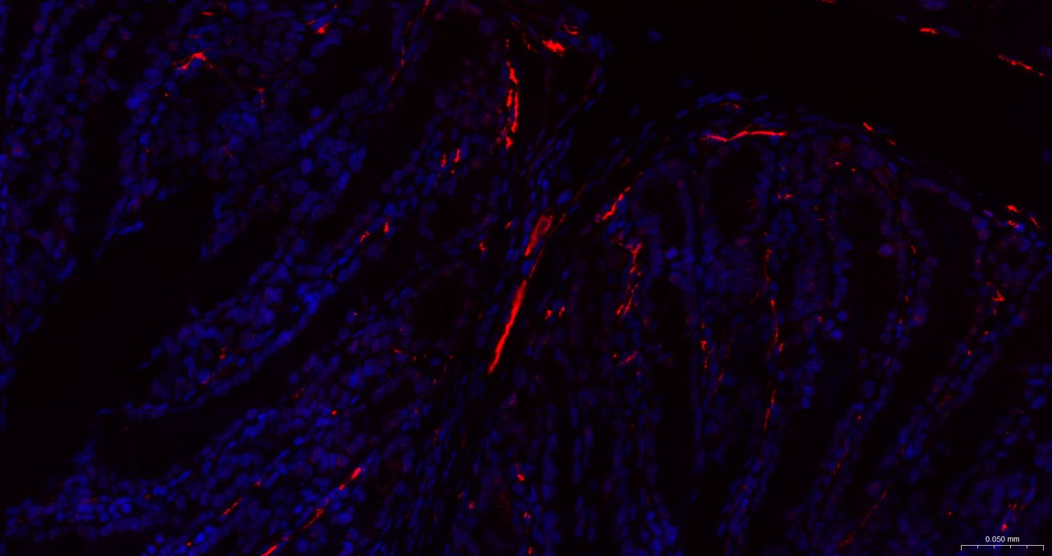 Streptavidin, BF594 conjugated (标记蛋白质与多肽) - IF | Bioss