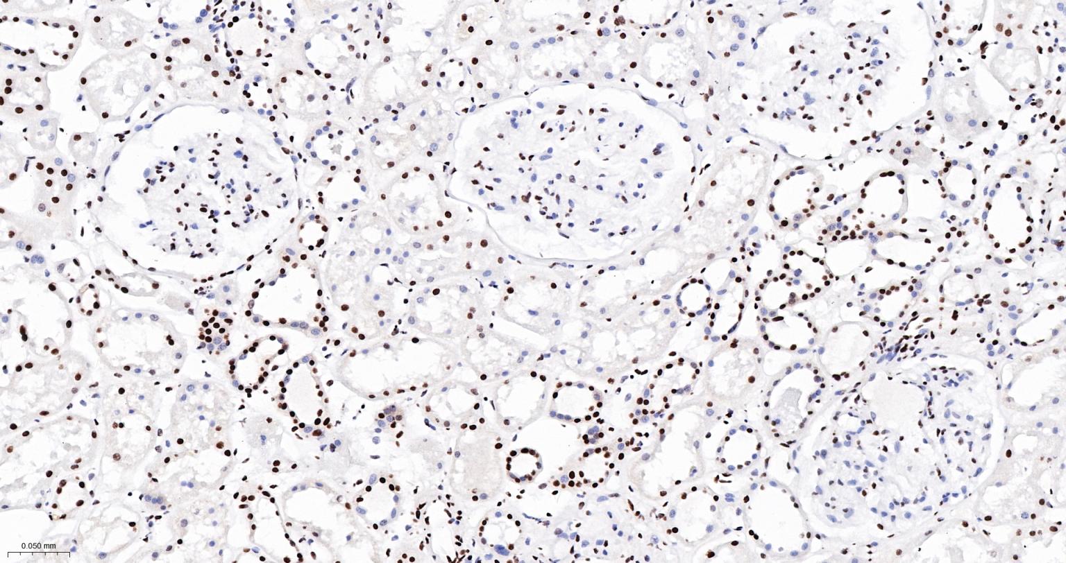 TATA结合蛋白重组兔单抗-bsm-61179R