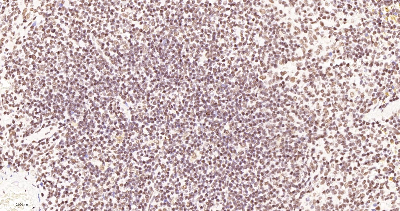 TATA结合蛋白重组兔单抗-bsm-61179R