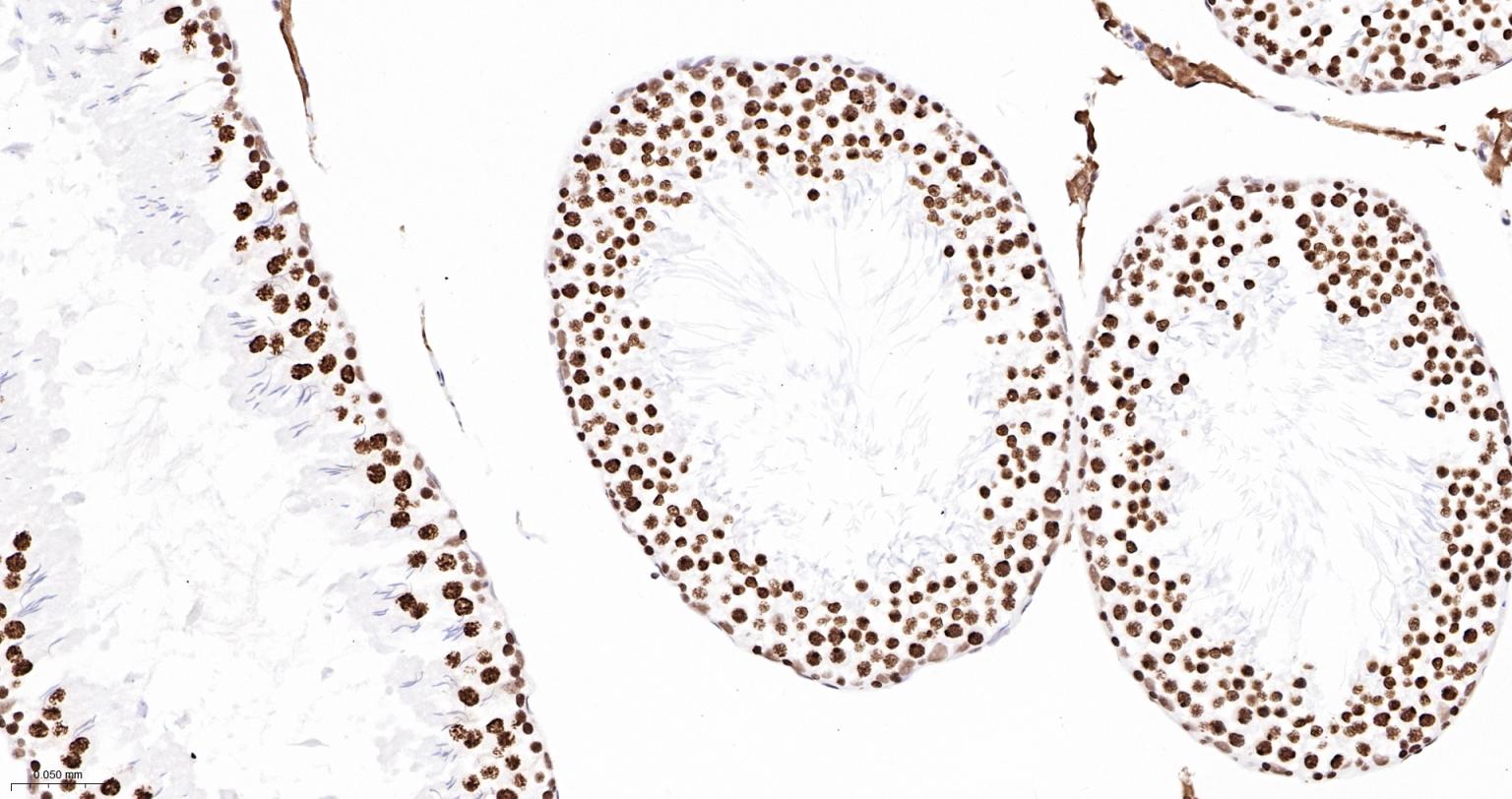 TATA结合蛋白重组兔单抗-bsm-61179R