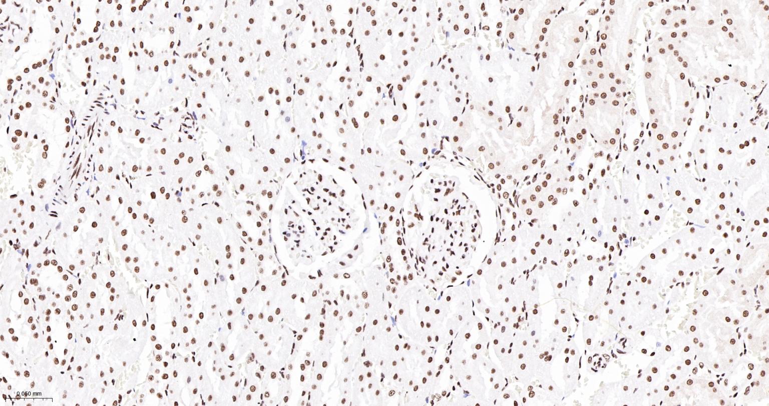 TATA结合蛋白重组兔单抗-bsm-61179R
