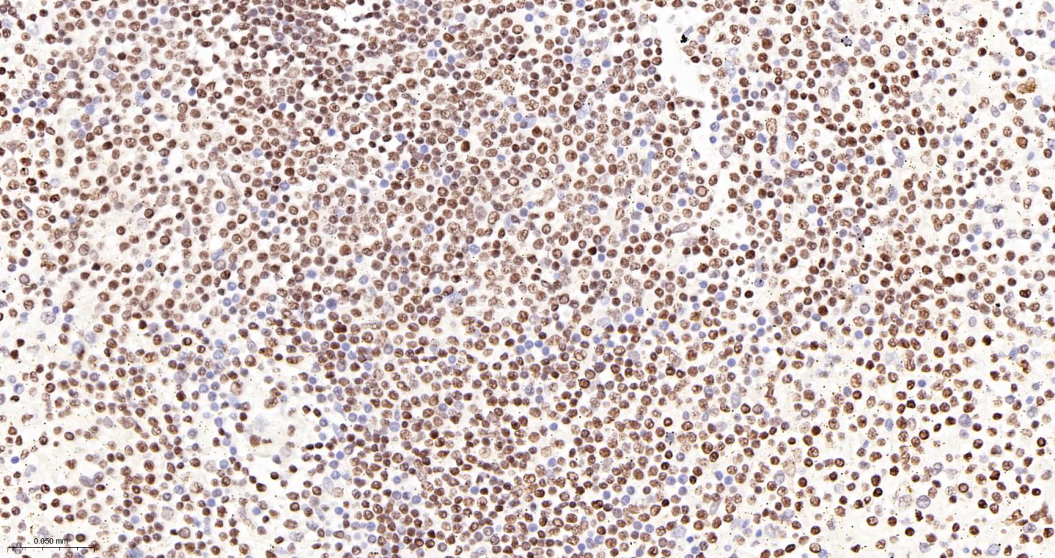 TATA结合蛋白重组兔单抗-bsm-61179R