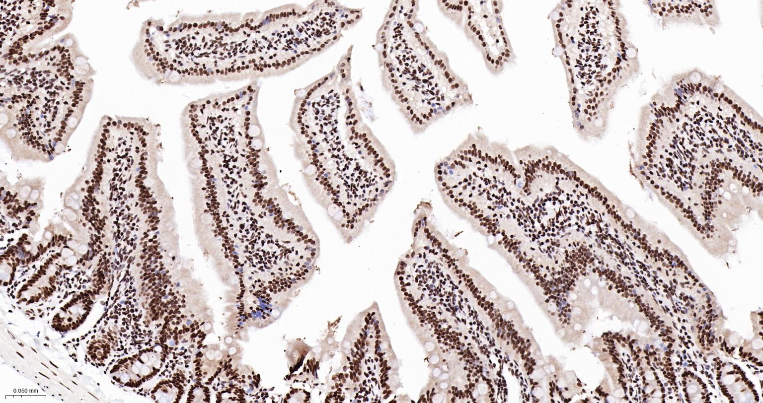 TATA结合蛋白重组兔单抗-bsm-61179R