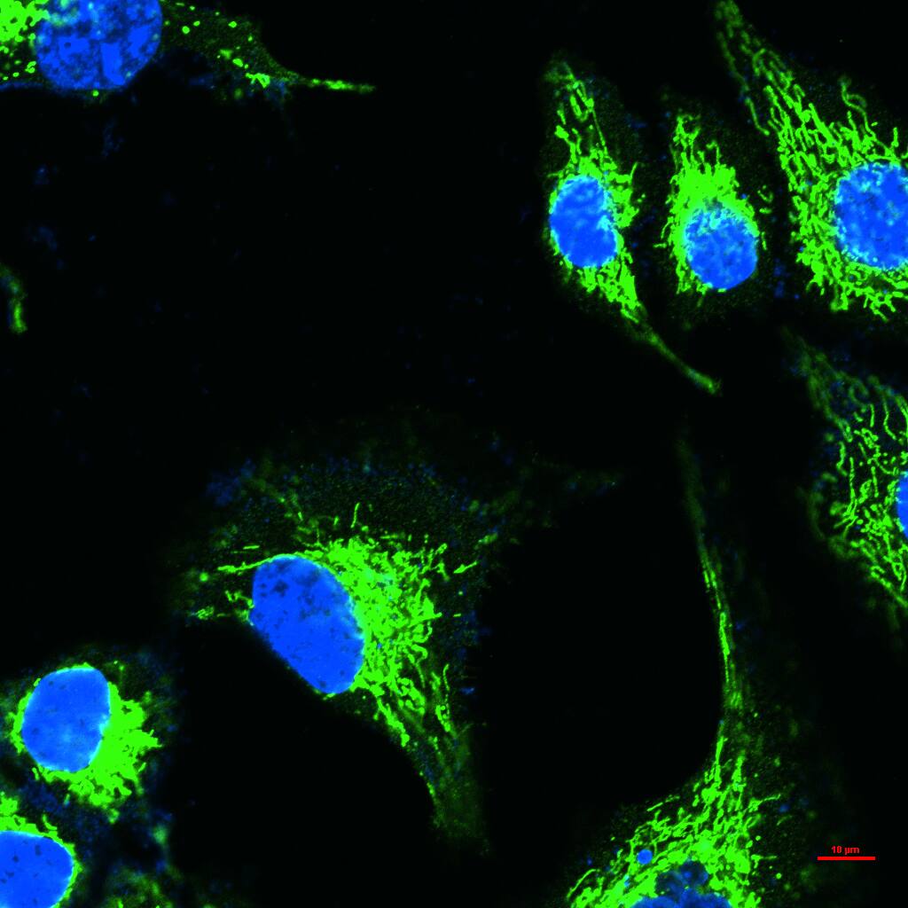 热休克蛋白-60/groEL重组兔单抗-bsm-61183R