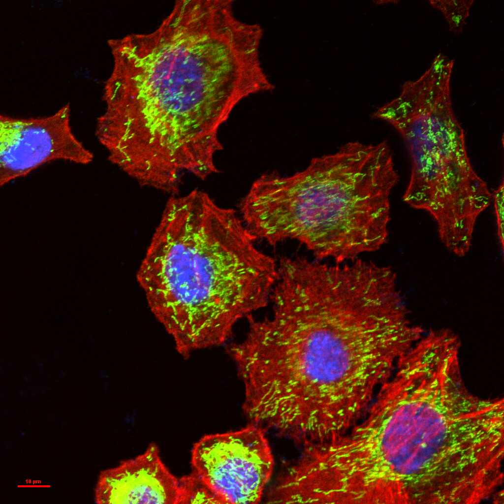 HSP60 Recombinant Rabbit mAb (一抗) - WB,IHC-P,IHC-F,IF,Flow-Cyt,ICC/IF | Bioss