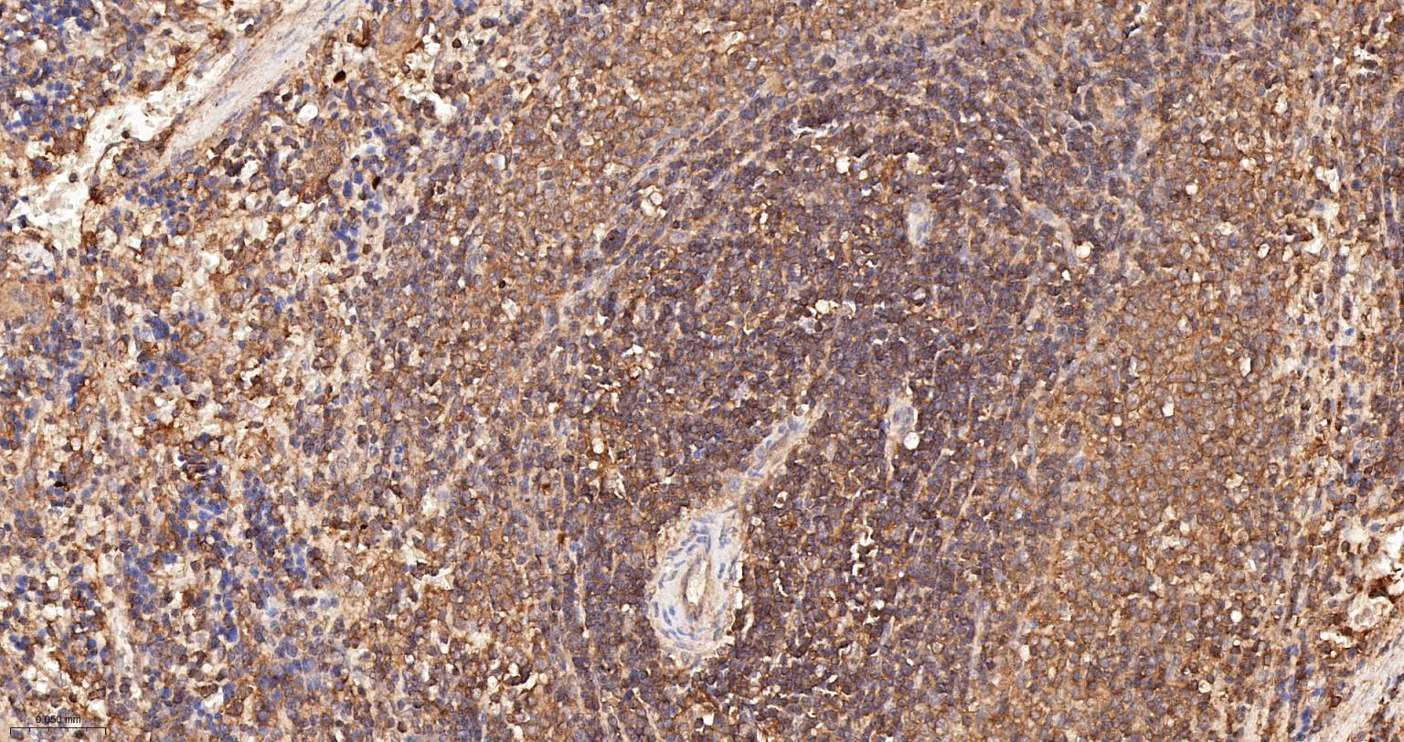 NDUFS2重组兔单抗-bsm-62748R