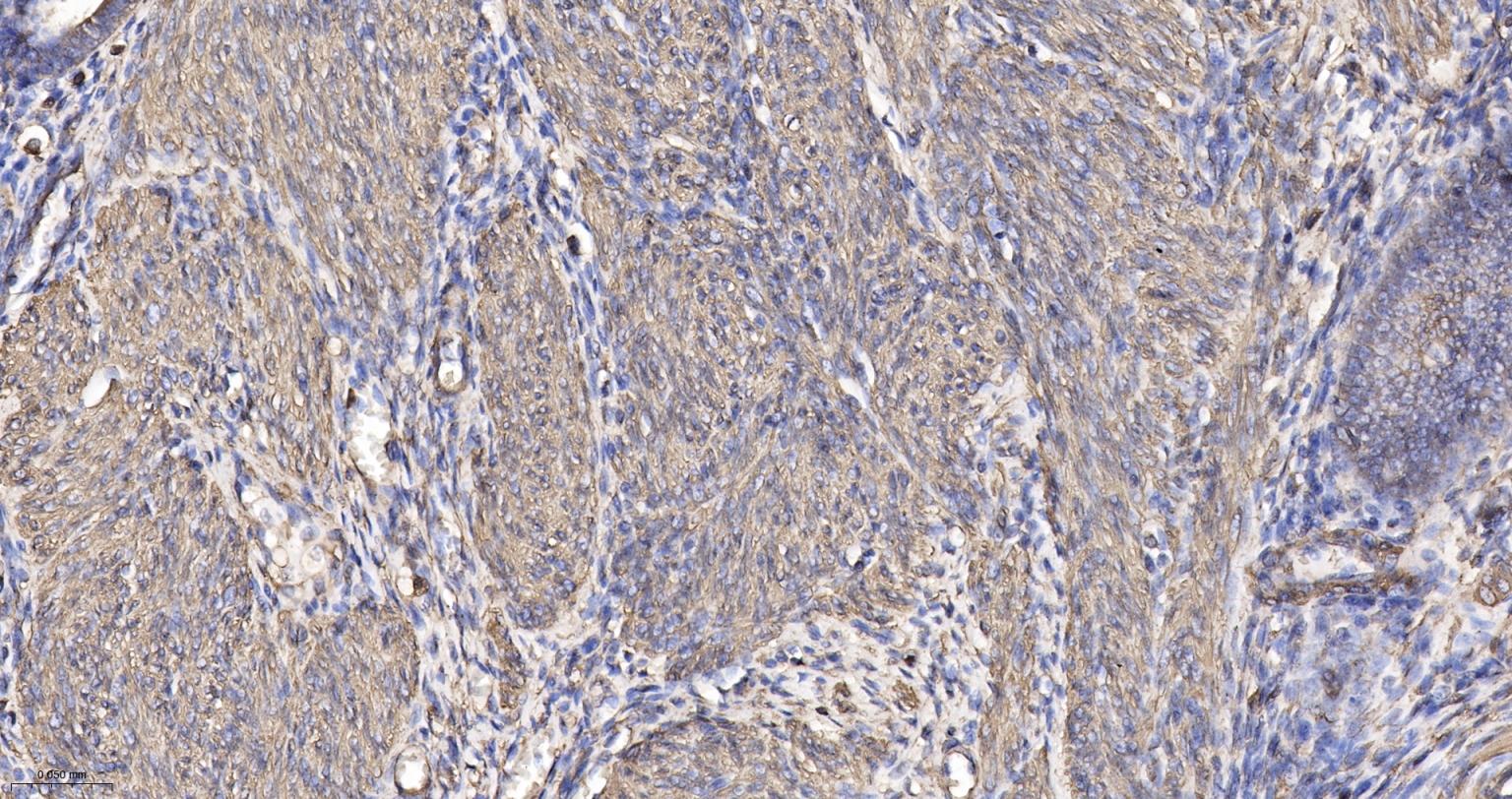 β-肌动蛋白/β-Actin（内参）重组兔单抗-bsm-63325R
