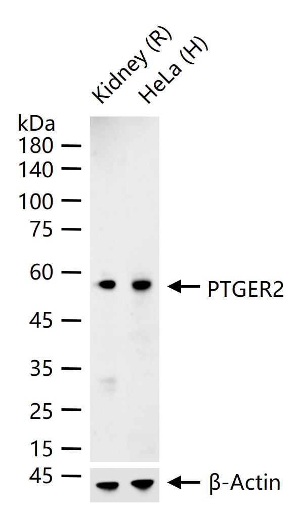 PTGER2 Recombinant Rabbit mAb (一抗) - WB | Bioss