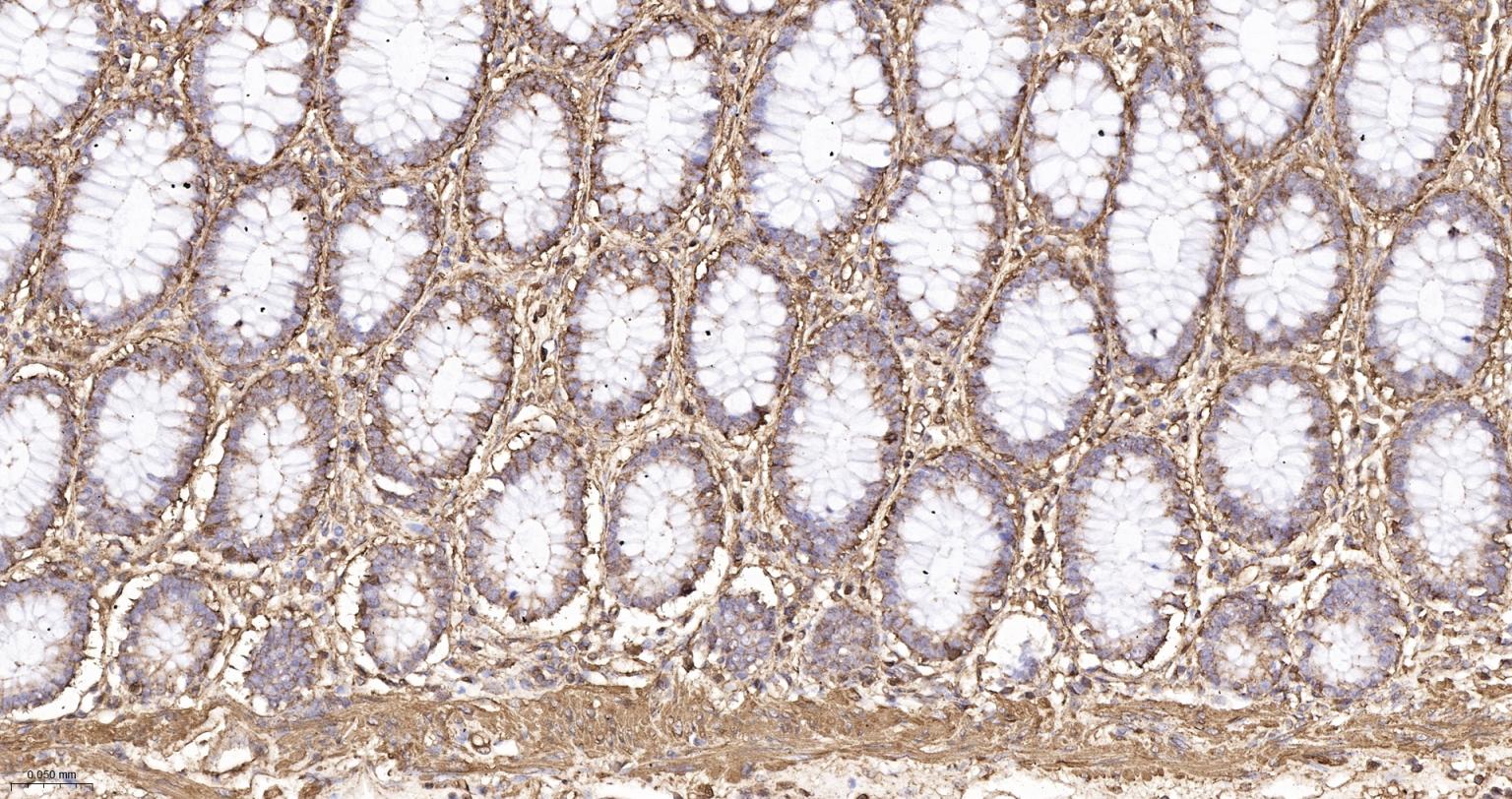β-肌动蛋白/β-Actin（内参）重组兔单抗-bsm-63325R