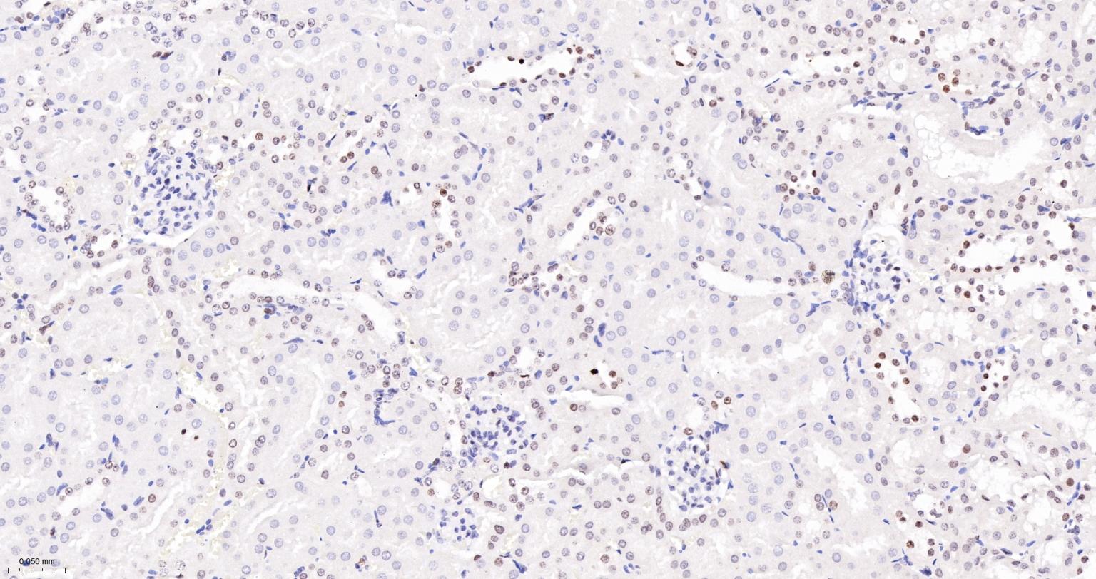 磷酸化组蛋白H2AX重组兔单抗-bsm-52163R