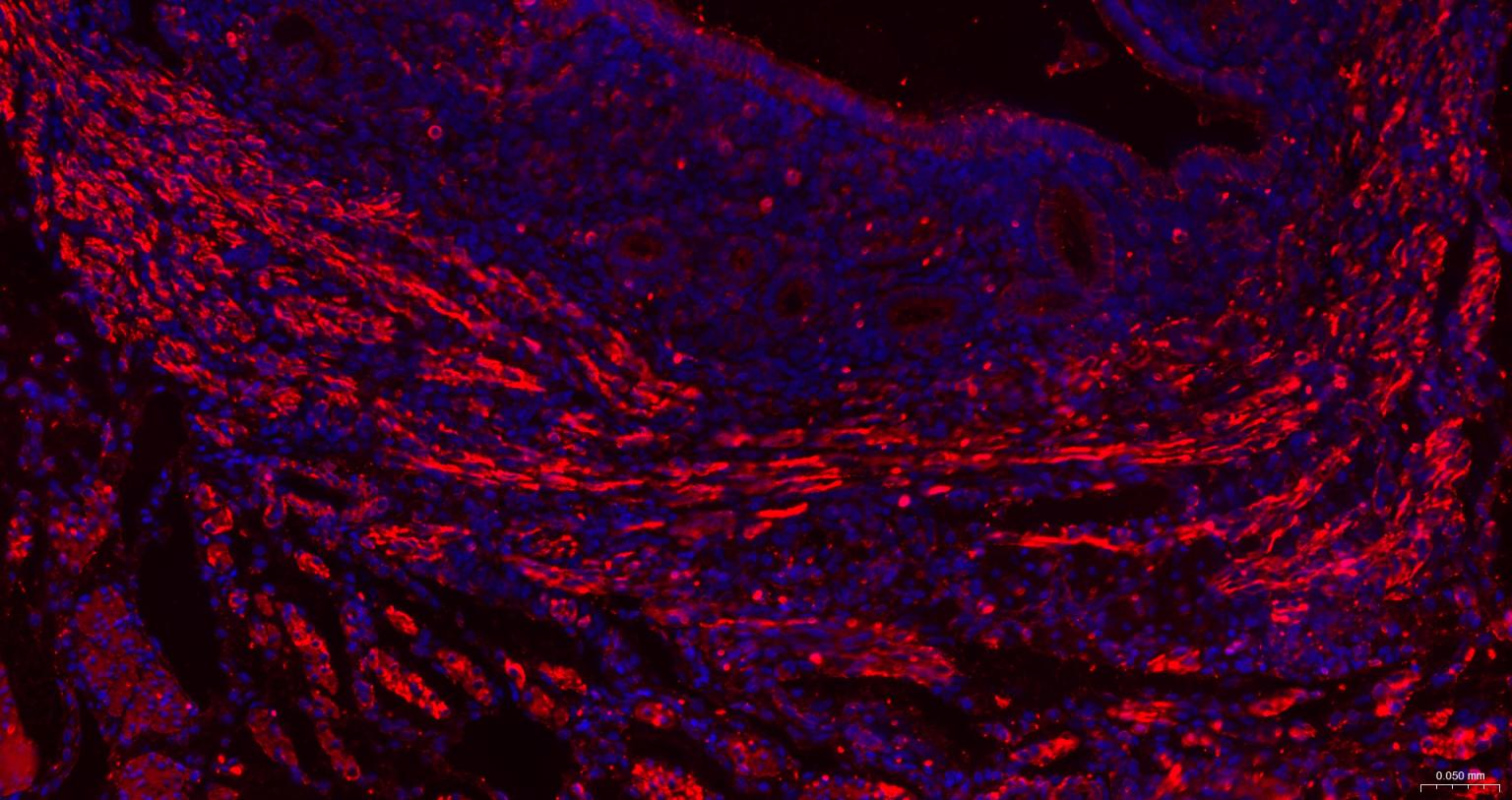β-肌动蛋白/β-Actin（内参）重组兔单抗-bsm-63325R