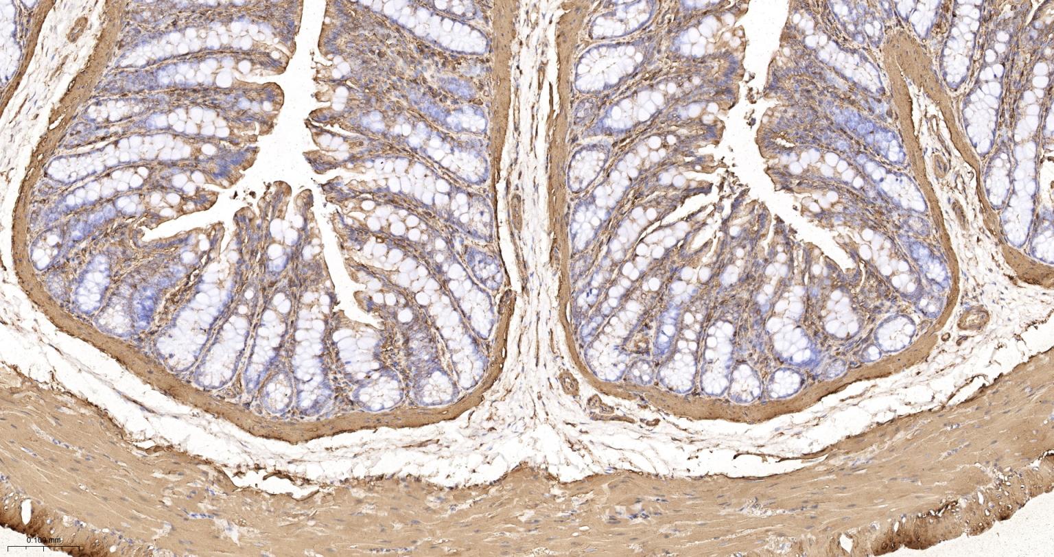 β-肌动蛋白/β-Actin（内参）重组兔单抗-bsm-63325R