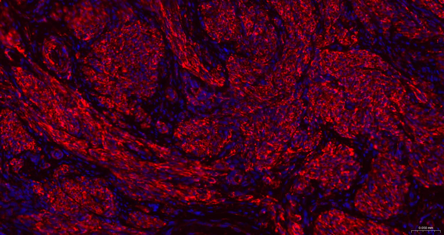 β-肌动蛋白/β-Actin（内参）重组兔单抗-bsm-63325R