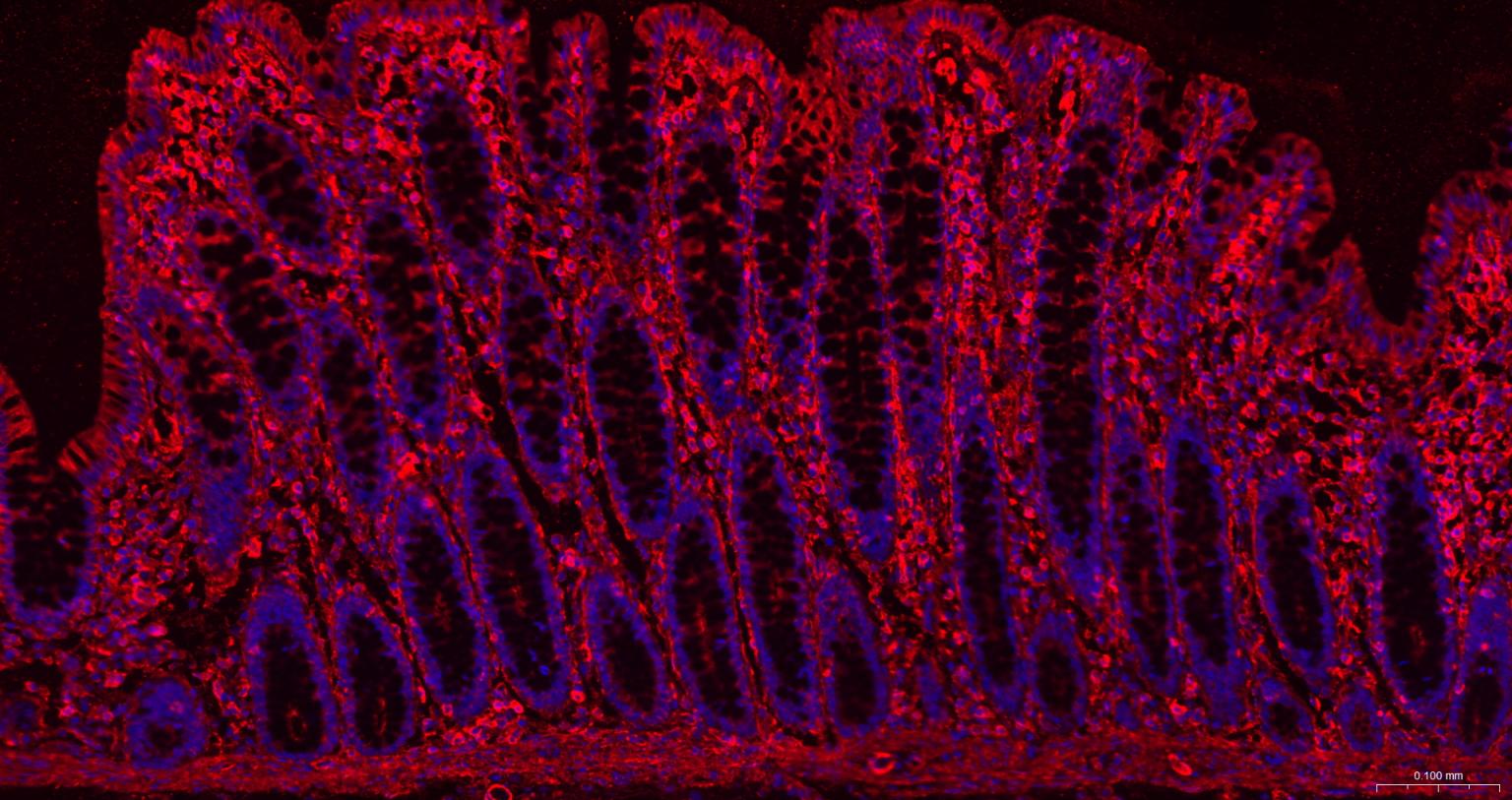 β-肌动蛋白/β-Actin（内参）重组兔单抗-bsm-63325R