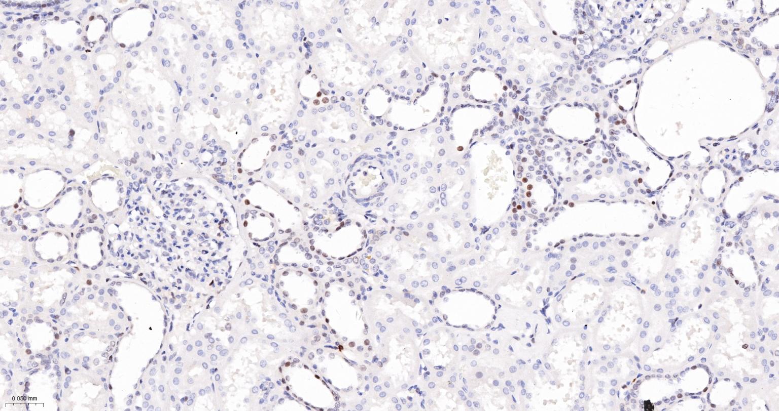 磷酸化组蛋白H2AX重组兔单抗-bsm-52163R