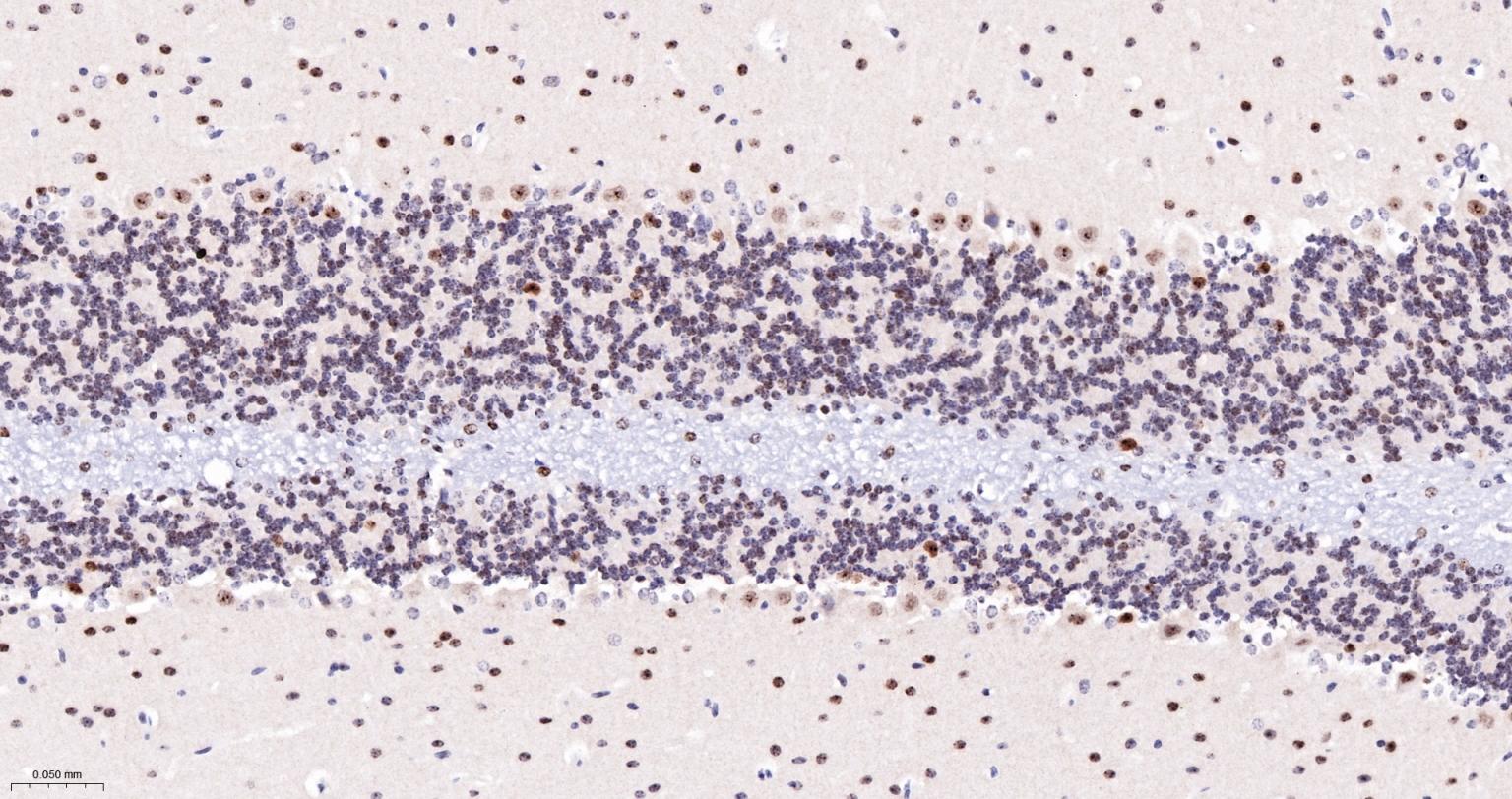 磷酸化组蛋白H2AX重组兔单抗-bsm-52163R