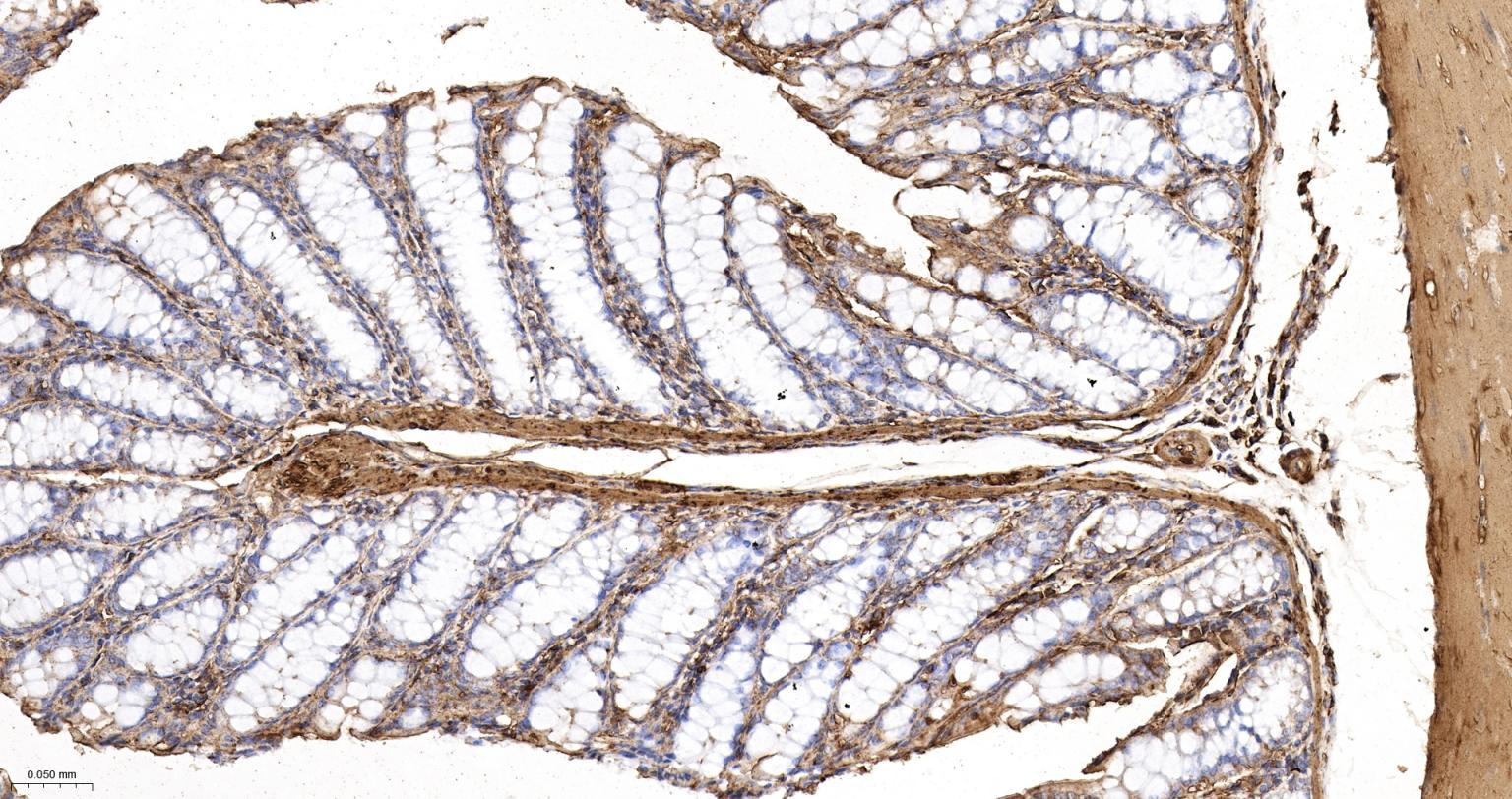 β-肌动蛋白/β-Actin（内参）重组兔单抗-bsm-63325R