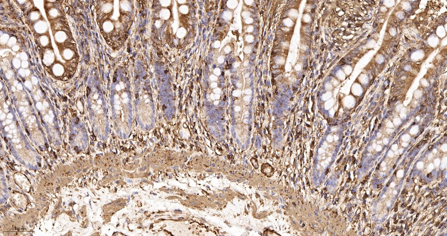 β-肌动蛋白/β-Actin（内参）重组兔单抗-bsm-63325R