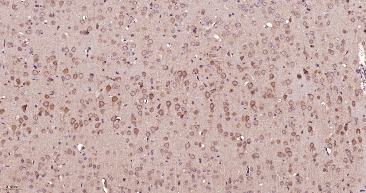 谷氨酰胺酶重组兔单抗-bsm-60888R