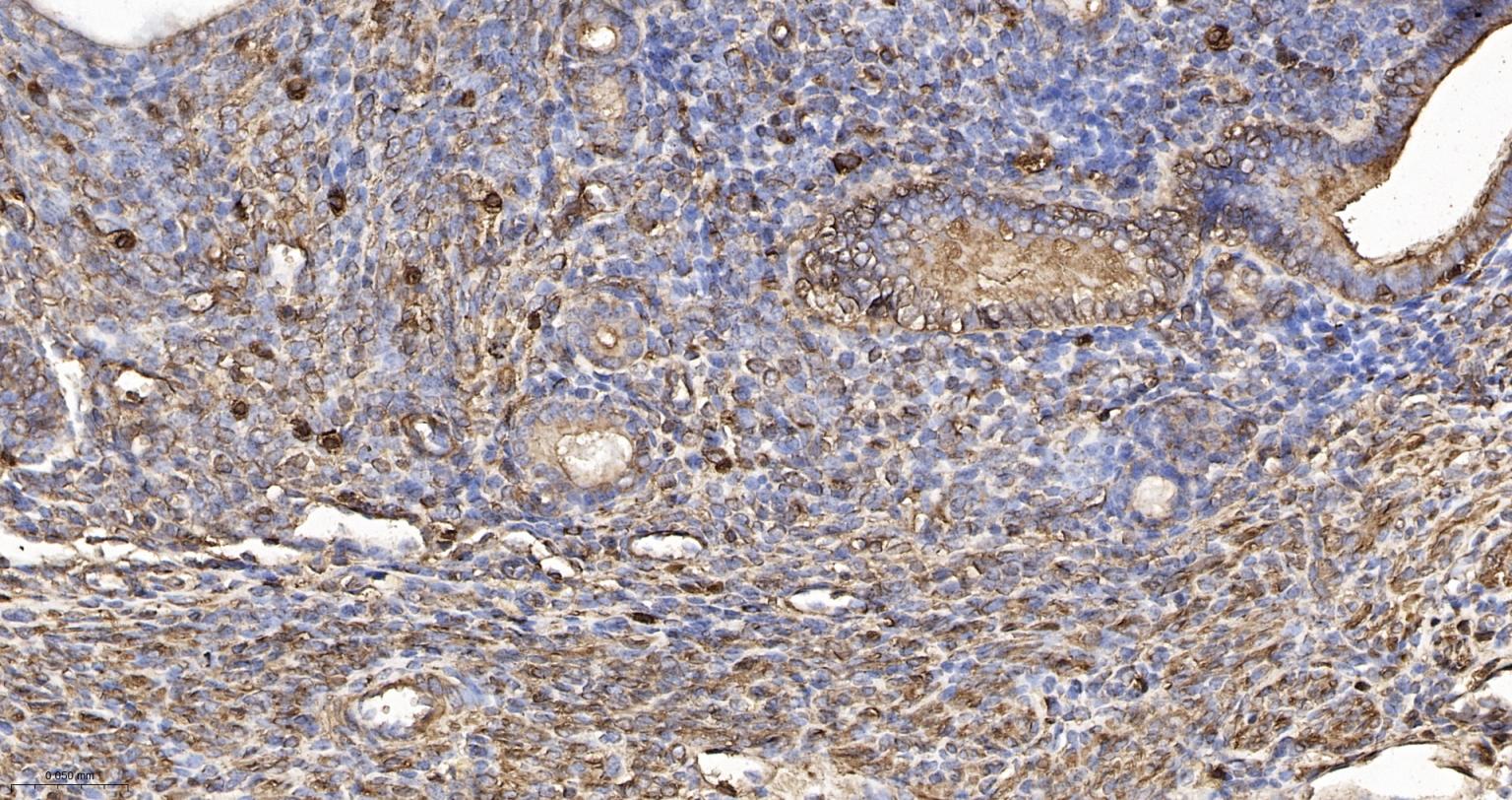 β-肌动蛋白/β-Actin（内参）重组兔单抗-bsm-63325R