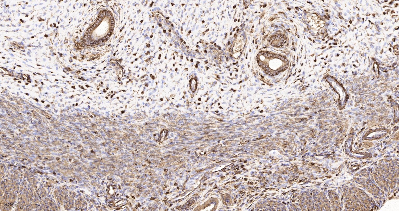 β-肌动蛋白/β-Actin（内参）重组兔单抗-bsm-63325R