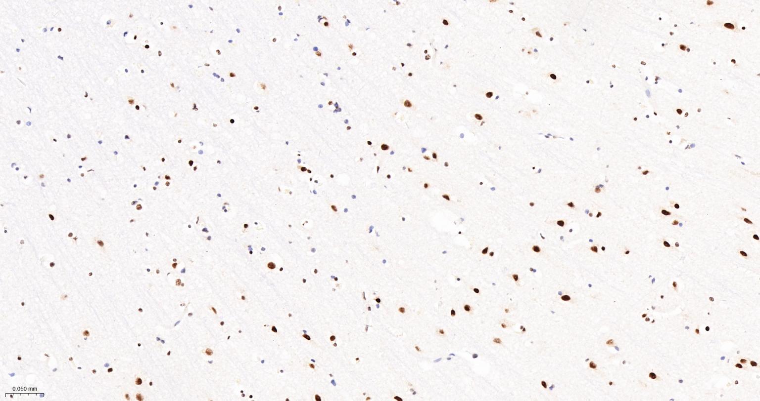 Tar DNA 结合蛋白43/TDP-43重组小鼠单抗-bsm-60381M