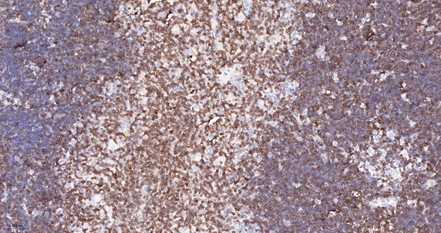 CD3G重组兔单抗-bsm-54300R