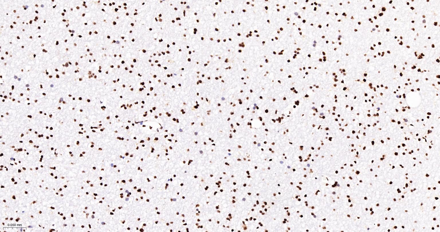 Tar DNA 结合蛋白43/TDP-43重组小鼠单抗-bsm-60381M