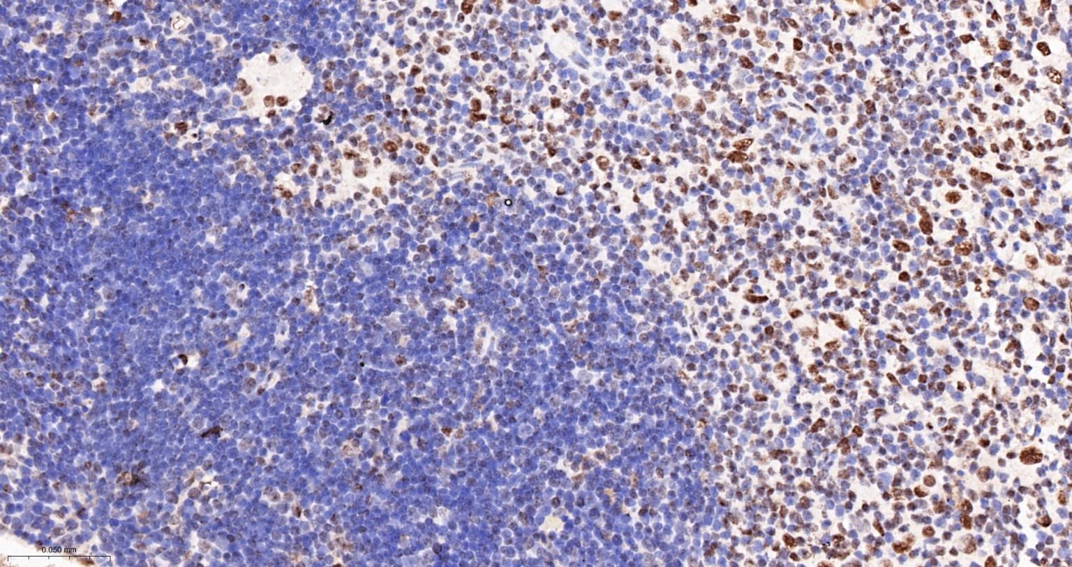 Tar DNA 结合蛋白43/TDP-43重组小鼠单抗-bsm-60381M