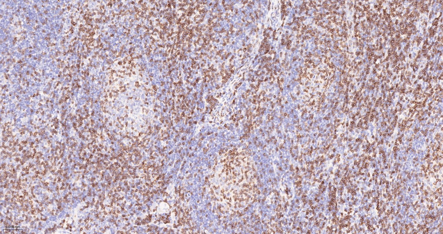 CD3G重组兔单抗-bsm-54300R