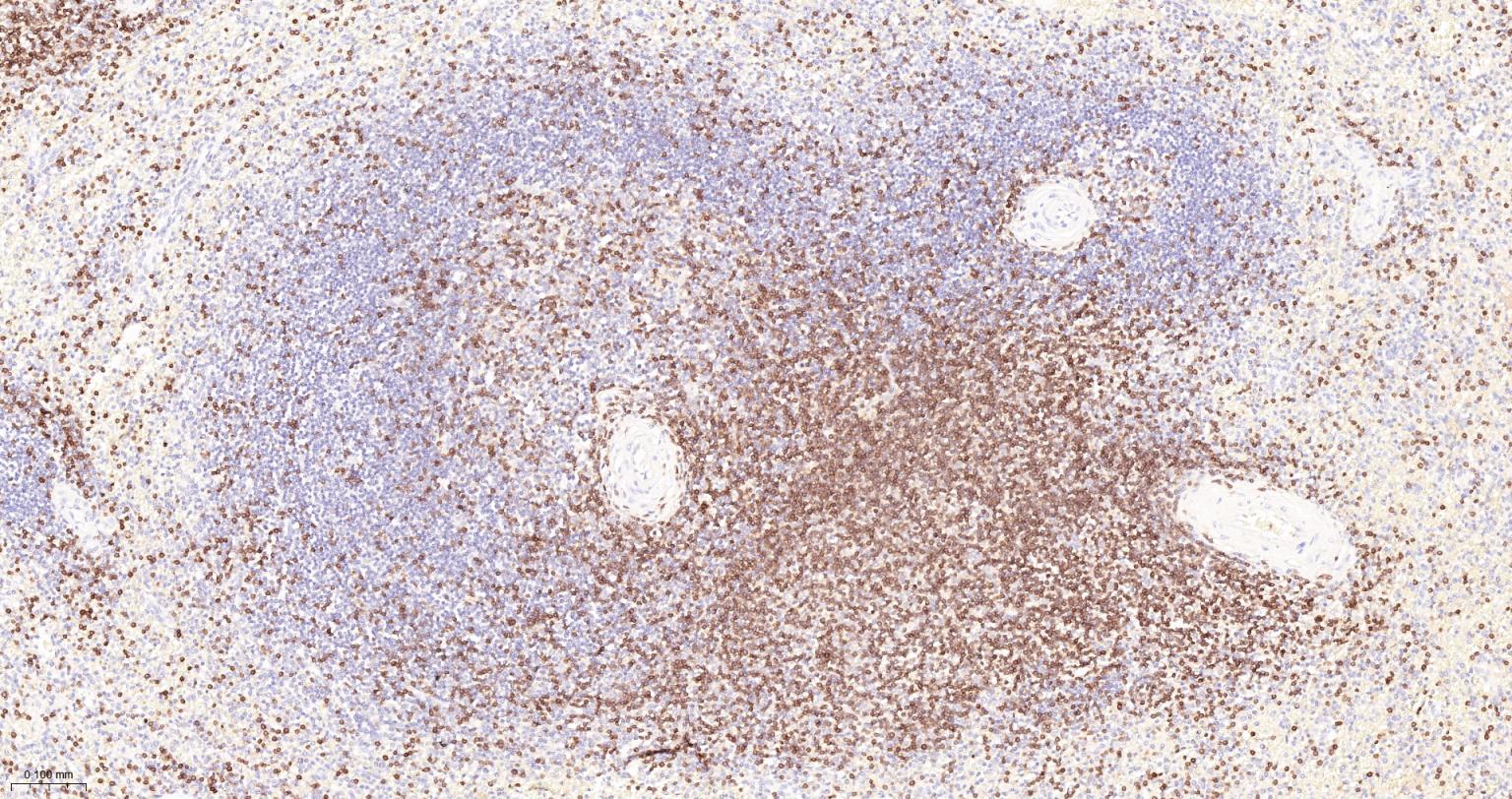 CD3G重组兔单抗-bsm-54300R