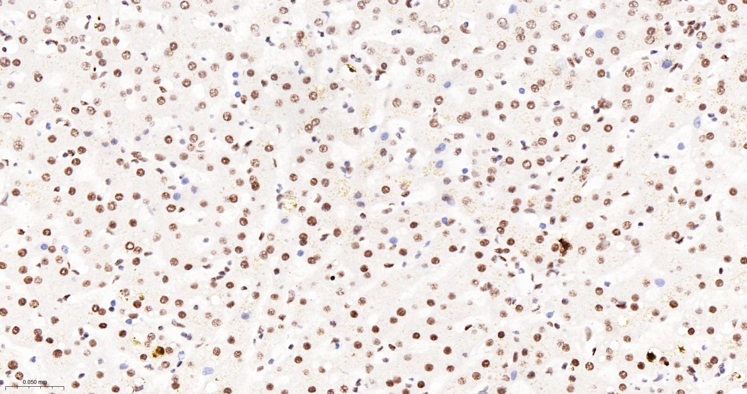 Tar DNA 结合蛋白43/TDP-43重组小鼠单抗-bsm-60381M