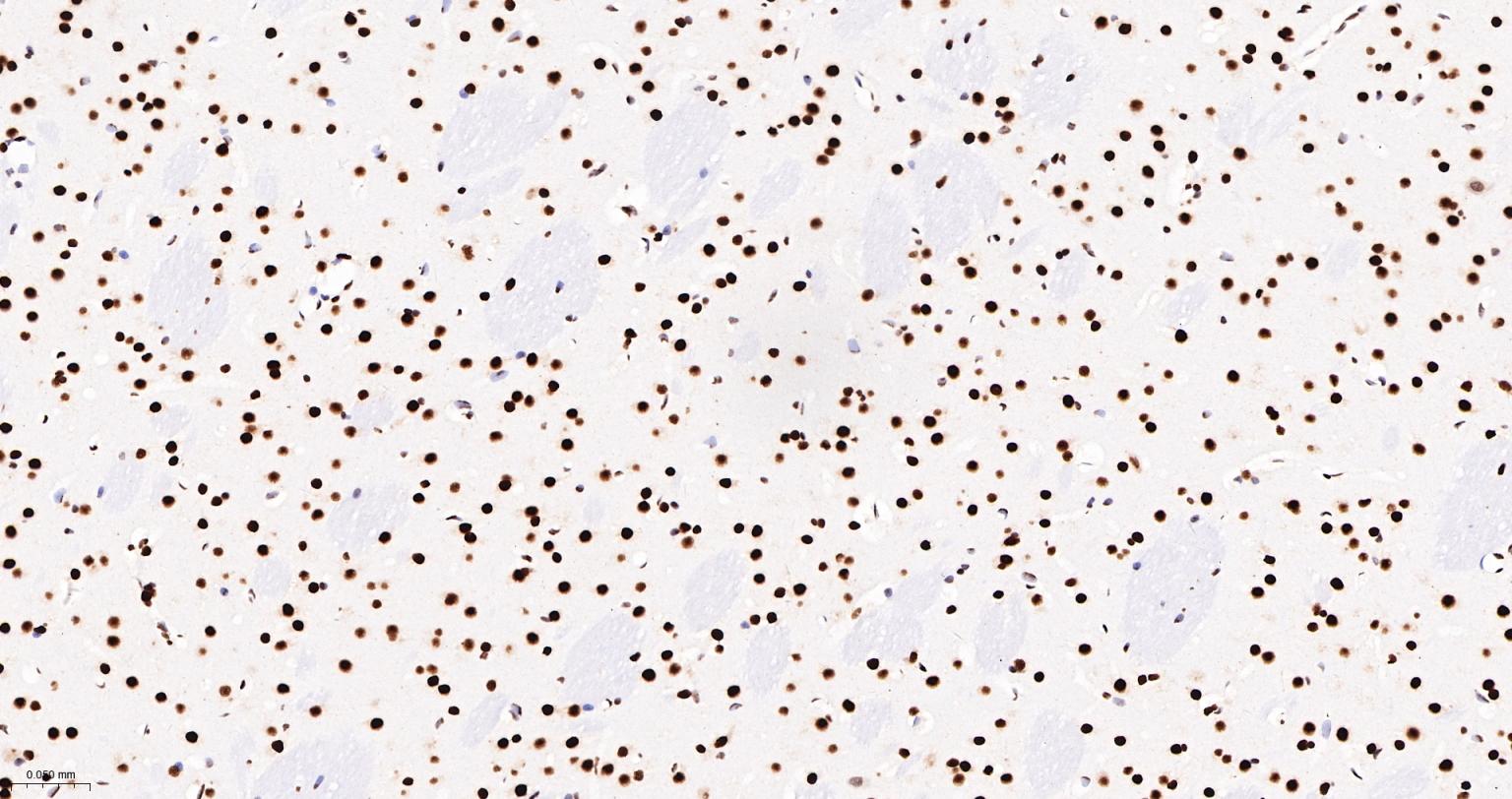 Tar DNA 结合蛋白43/TDP-43重组小鼠单抗-bsm-60381M