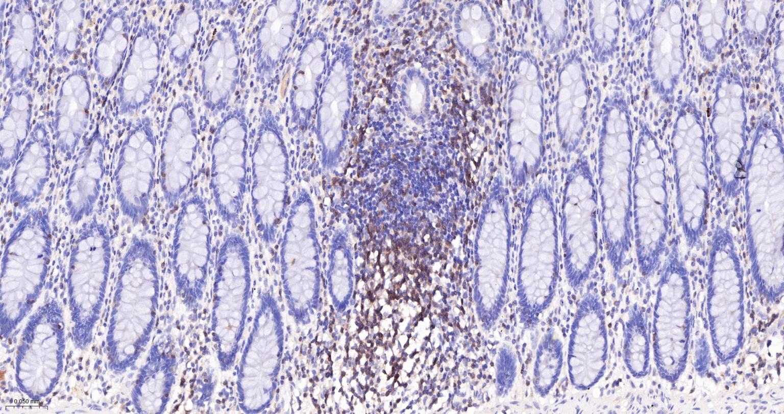 CD3G重组兔单抗-bsm-54300R