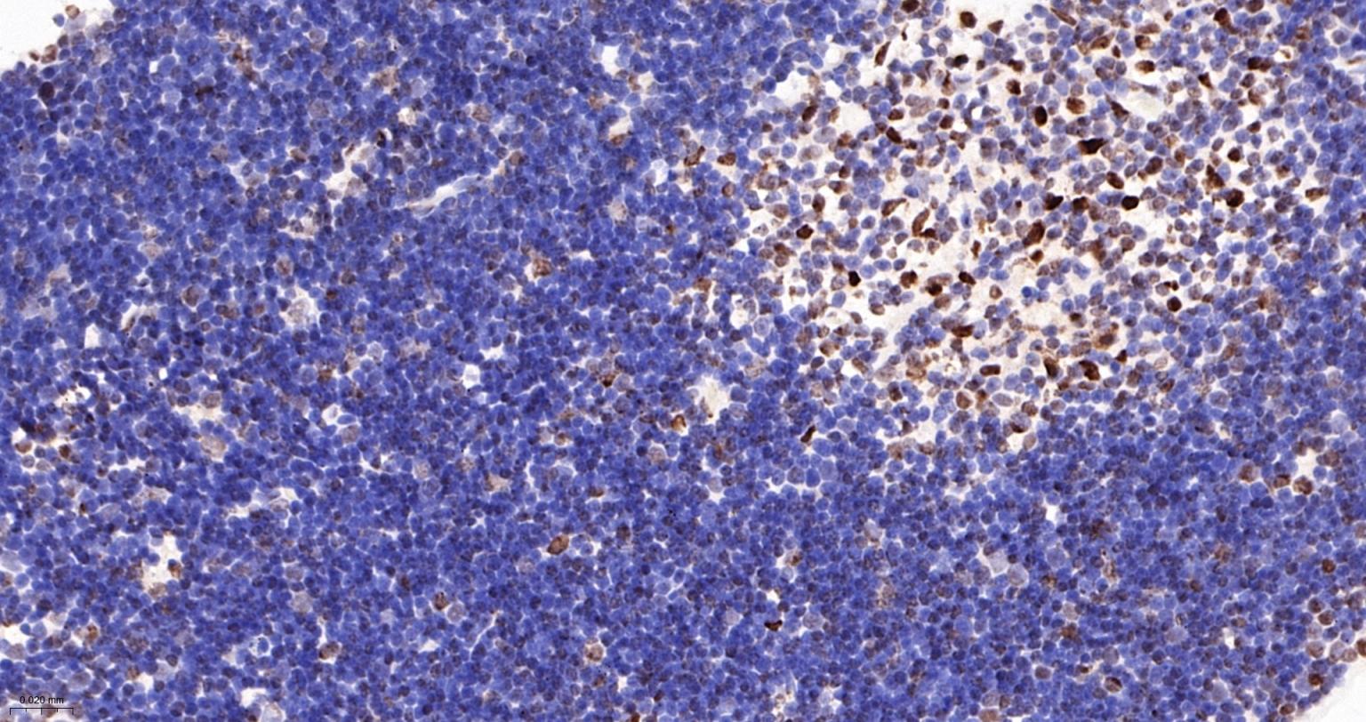 Tar DNA 结合蛋白43/TDP-43重组小鼠单抗-bsm-60381M