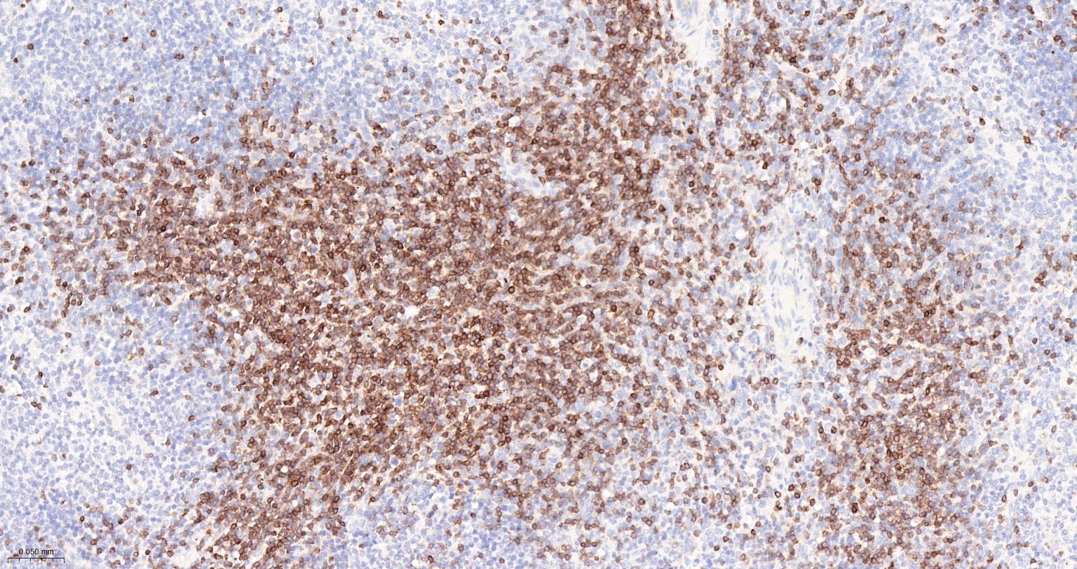 CD3G重组兔单抗-bsm-54300R