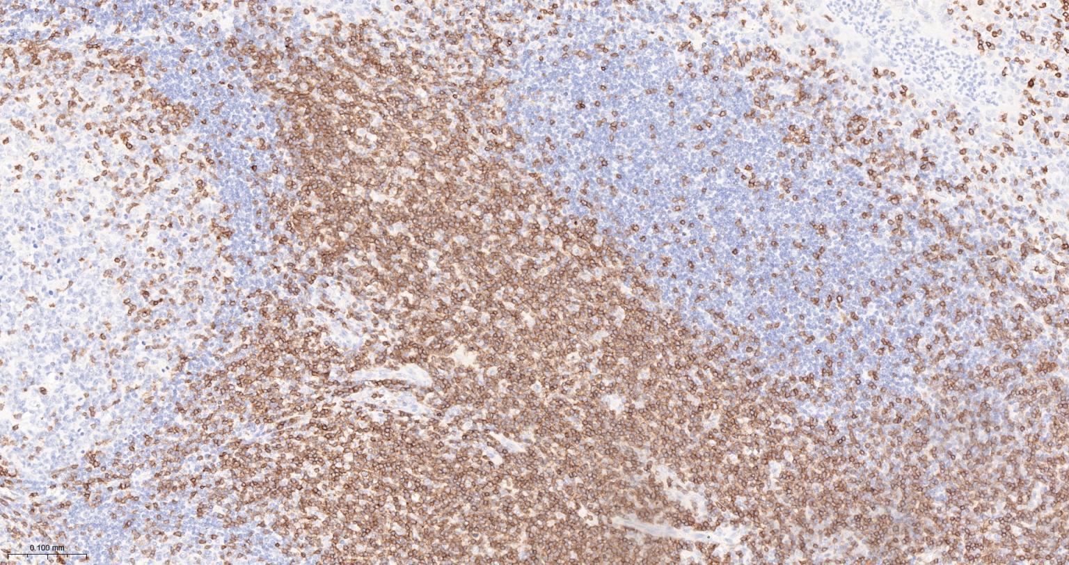 CD3G重组兔单抗-bsm-54300R