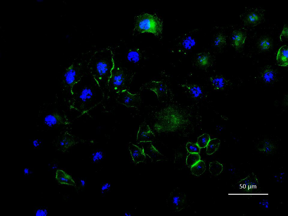 表皮生长因子受体重组兔单抗-bsm-52317R