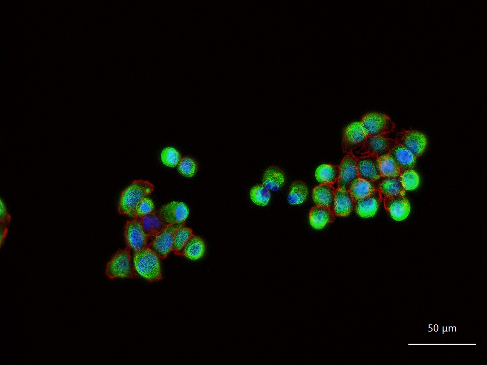 Cytokeratin 8 Recombinant Rabbit mAb (一抗) - WB,IHC-P,IHC-F,IF,ICC/IF | Bioss