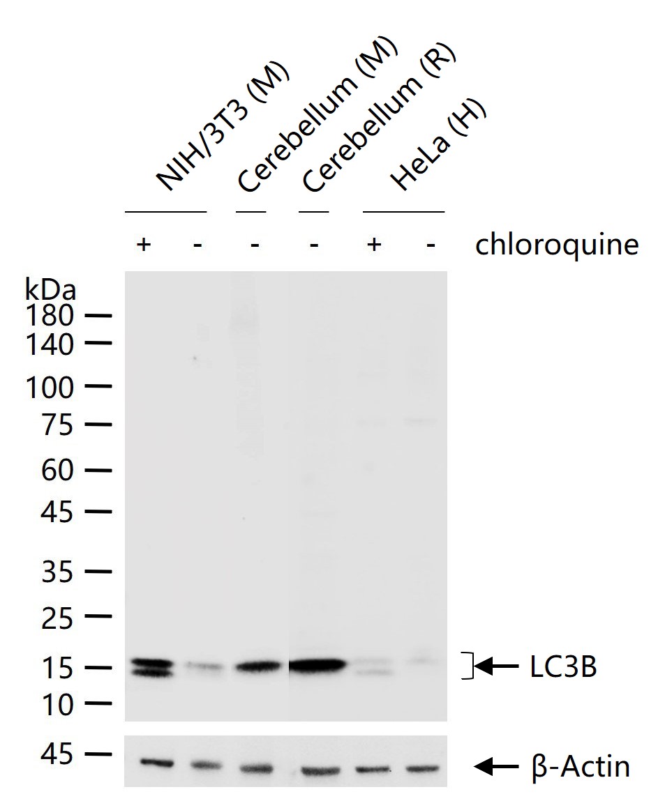 LC3B Recombinant Rabbit mAb (一抗) - WB,IHC-P,IHC-F,IF | Bioss